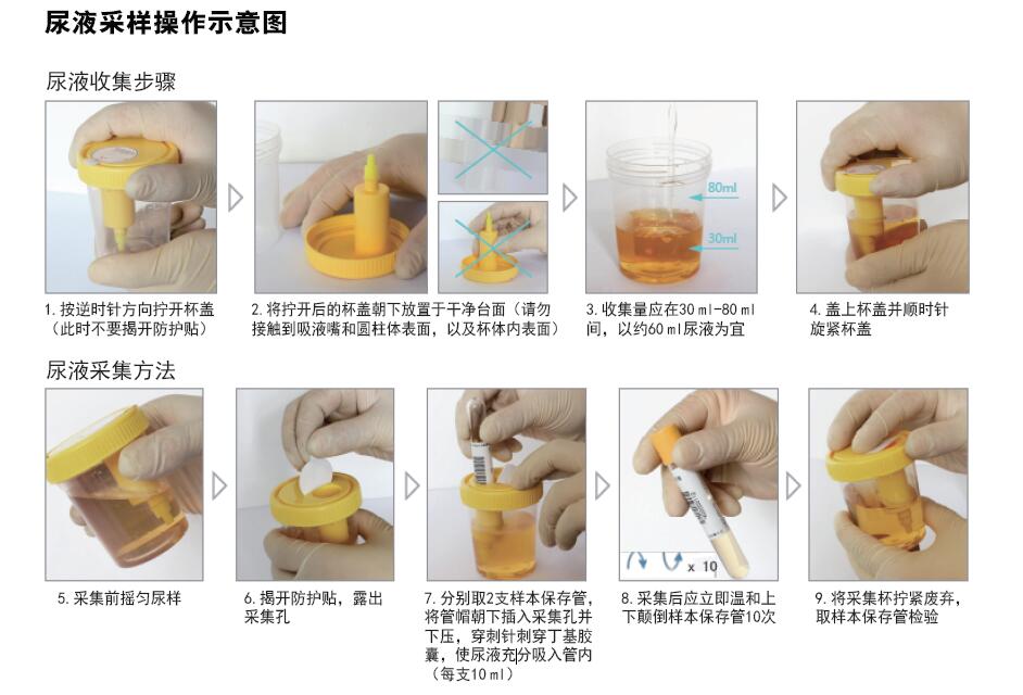 尿液DNA样本保存管