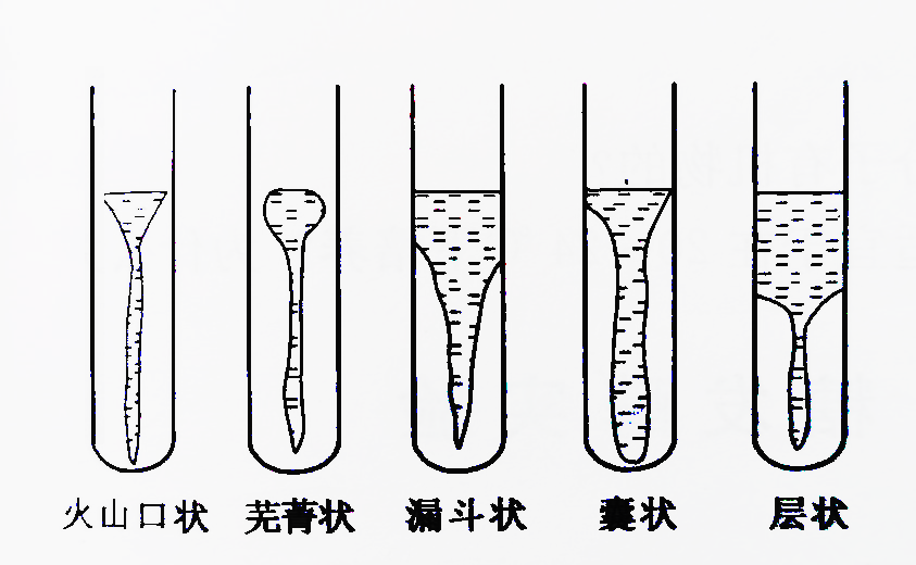 明胶培养基