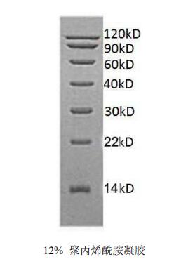 中分子量蛋白Marker(14～120kD)