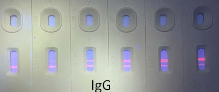 SARS-CoV-2 S蛋白抗体(IgG&IgM，阳性对照)