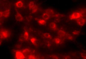 DiI细胞膜荧光探针(橙红色)