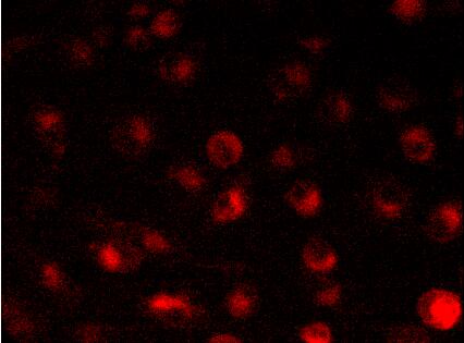 DiD细胞膜荧光探针(红色)
