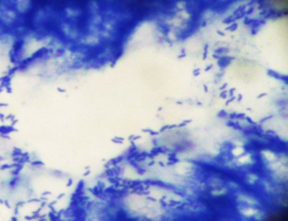 幽门螺旋杆菌染色试剂盒染色实例