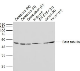 β-Tubulin单抗