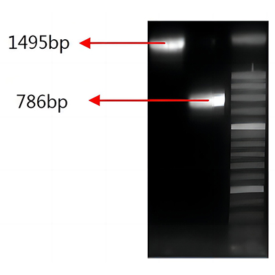 结核分枝杆菌基因分型试剂盒(VNTR-9)