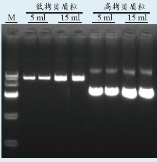 无内毒素质粒小量提试剂盒提取实例