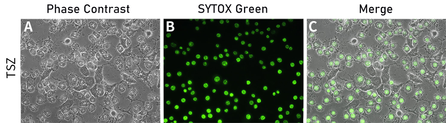 死细胞绿色荧光染色试剂盒荧光染色效果图 死细胞绿色荧光染色试剂盒荧光染色效果图