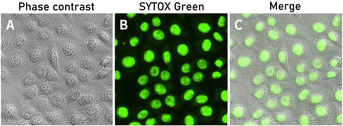 SYTOX Green细胞核染色效果图 SYTOX Green细胞核染色效果图
