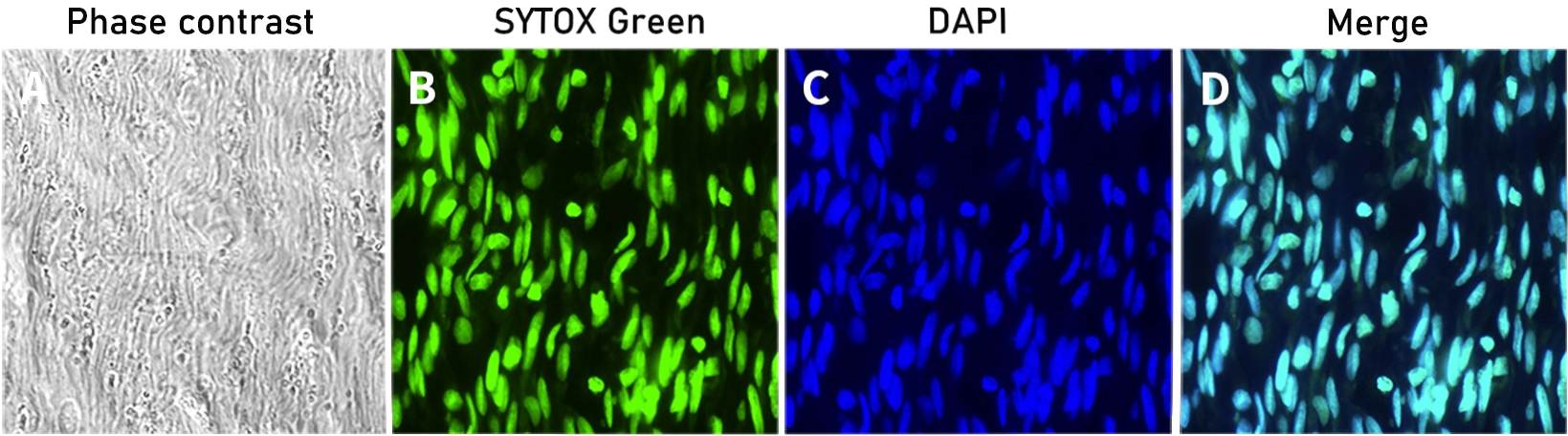 SYTOX Green细胞核染色效果图 SYTOX Green细胞核染色效果图