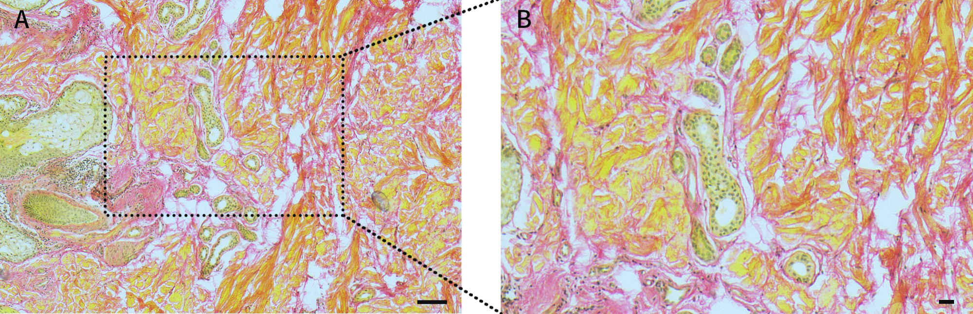 天狼星红染色试剂盒