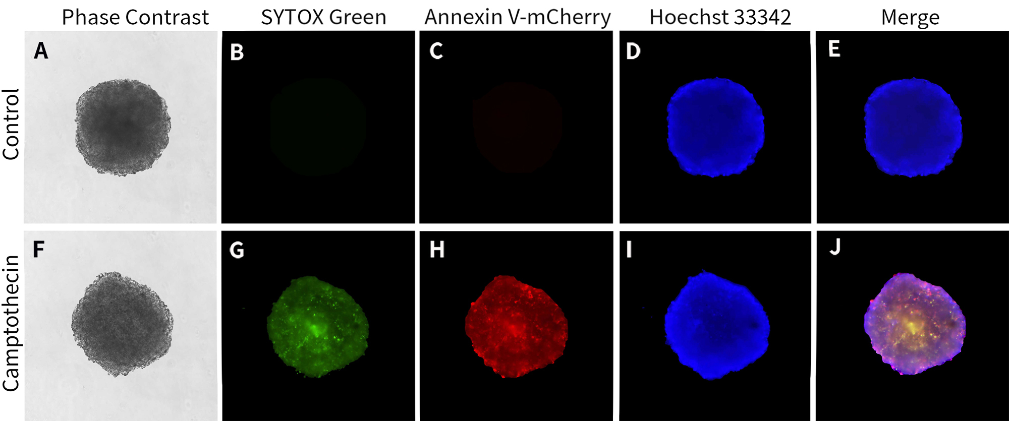 3D细胞凋亡检测试剂盒(Annexin V-mCherry/SYTOX Green) 3D细胞凋亡检测试剂盒(Annexin V-mCherry/SYTOX Green)