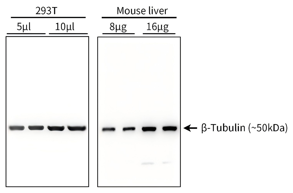 内参蛋白β-Tubulin检测试剂盒(Western方法)