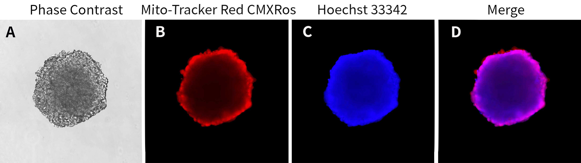 3D培养活细胞线粒体染色液(Mito-Tracker Red CMXRos) 3D培养活细胞线粒体染色液(Mito-Tracker Red CMXRos)