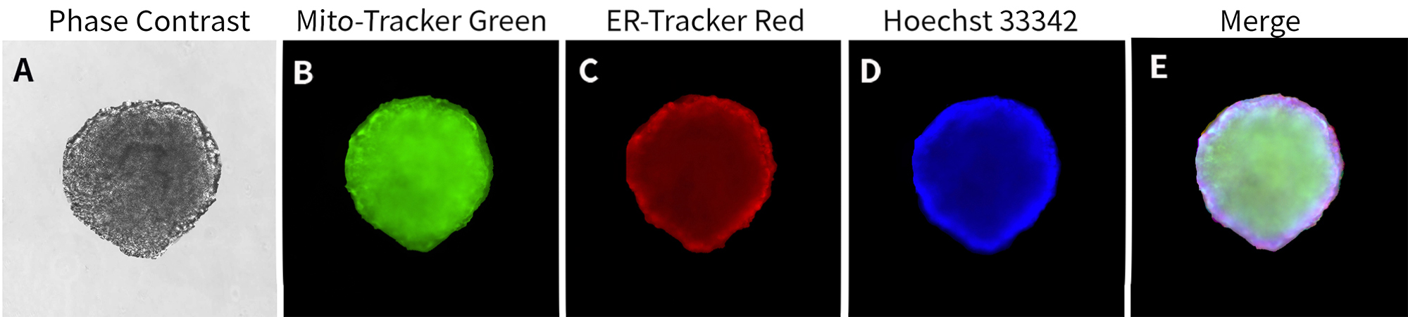 3D培养活细胞内质网染色试剂盒染色效果图 3D培养活细胞内质网染色试剂盒染色效果图