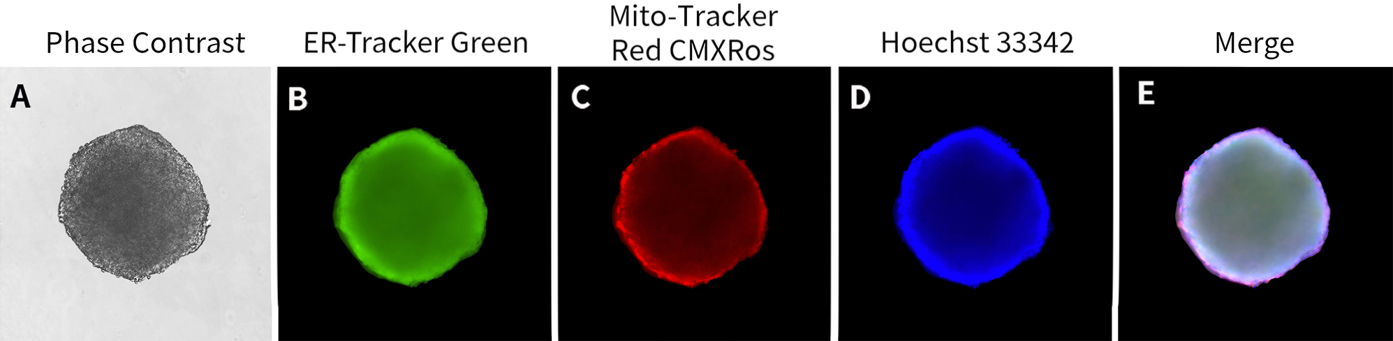 3D培养活细胞内质网染色试剂盒染色效果图 3D培养活细胞内质网染色试剂盒染色效果图
