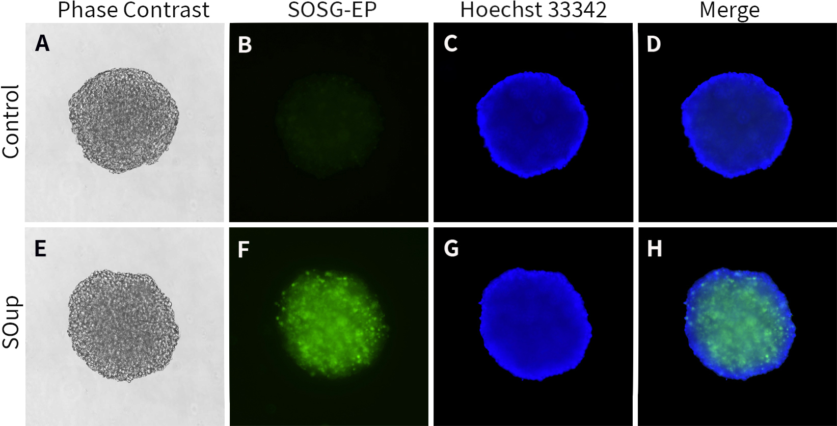 3D细胞单线态氧检测试剂盒(SOSG) 3D细胞单线态氧检测试剂盒(SOSG)