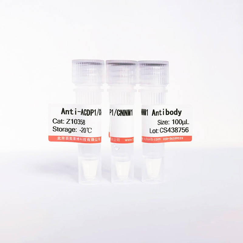ACDP1/CNNM1抗体图片 ACDP1/CNNM1抗体图片