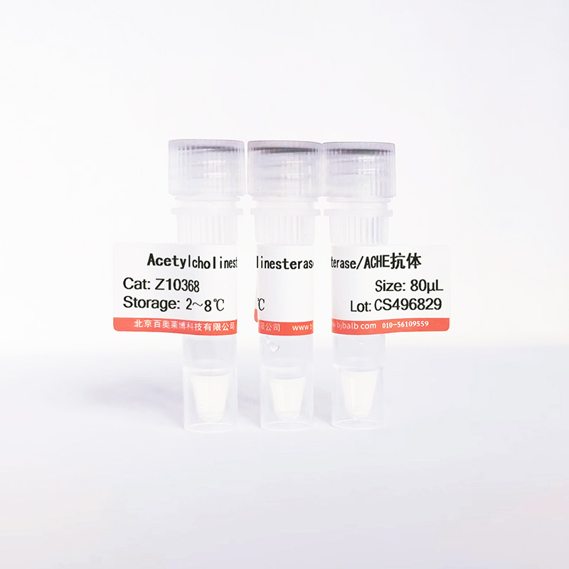 Acetylcholinesterase/ACHE抗体图片