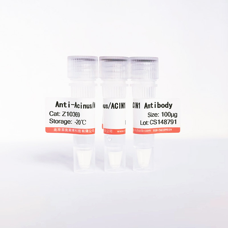 Acinus/ACIN1抗体图片 Acinus/ACIN1抗体图片