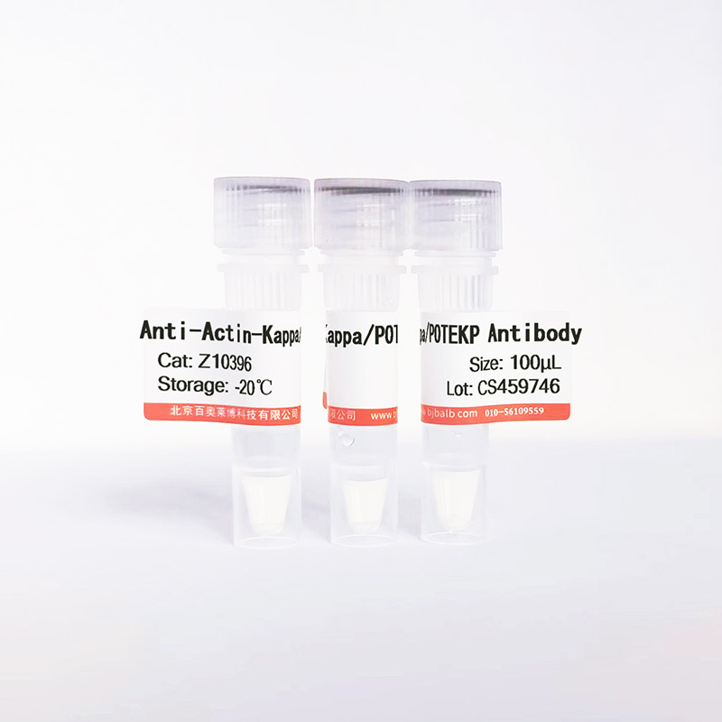 Actin-Kappa/POTEKP抗体图片 Actin-Kappa/POTEKP抗体图片