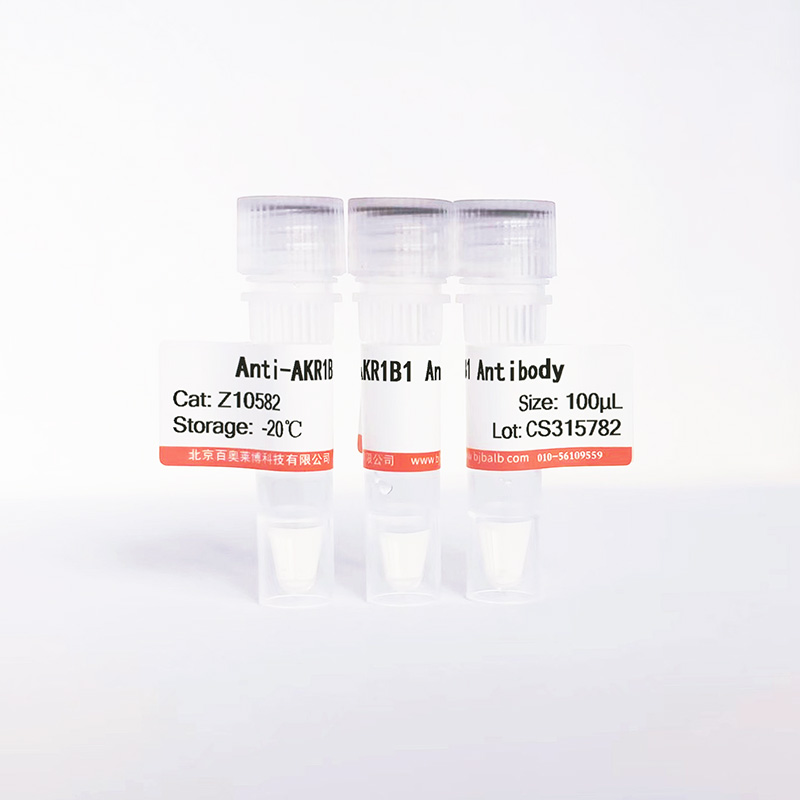 AKR1B1抗体图片 AKR1B1抗体图片