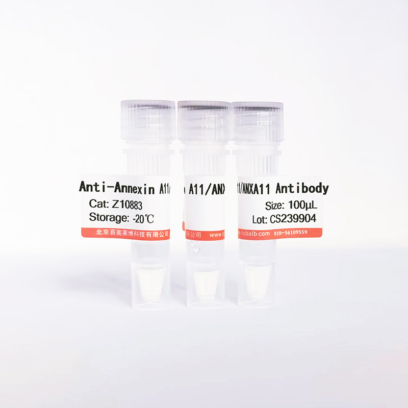 Annexin A11/ANXA11抗体图片 Annexin A11/ANXA11抗体图片