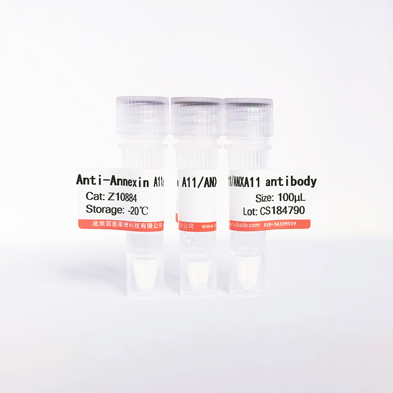 Annexin A11/ANXA11抗体图片 Annexin A11/ANXA11抗体图片