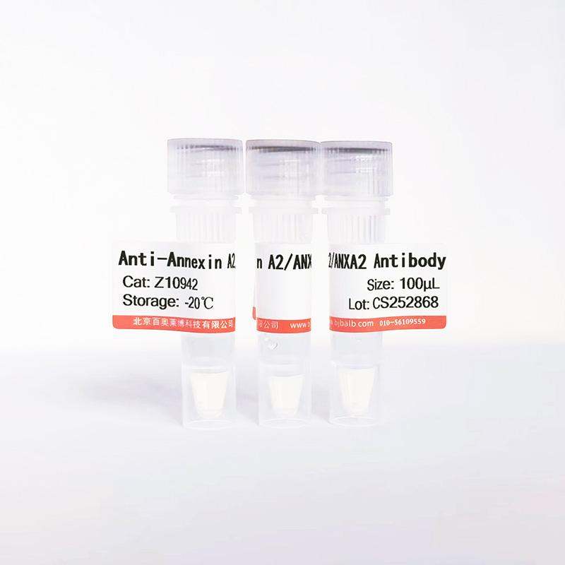 Annexin A2/ANXA2抗体图片 Annexin A2/ANXA2抗体图片