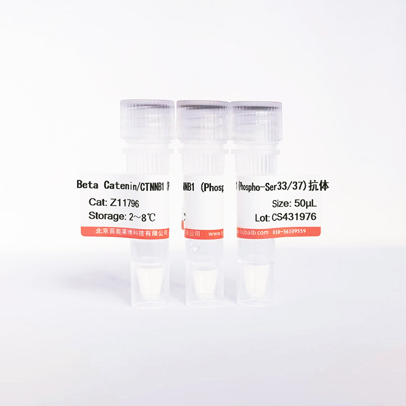 Beta Catenin/CTNNB1 (Phospho-Ser33/37)抗体图片