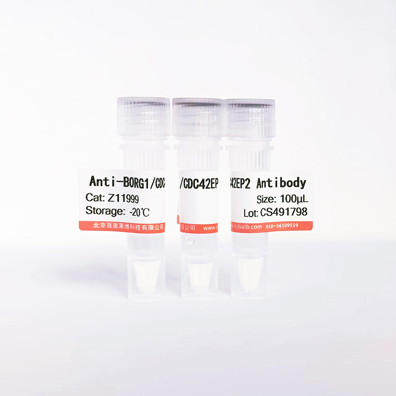 BORG1/CDC42EP2抗体图片 BORG1/CDC42EP2抗体图片