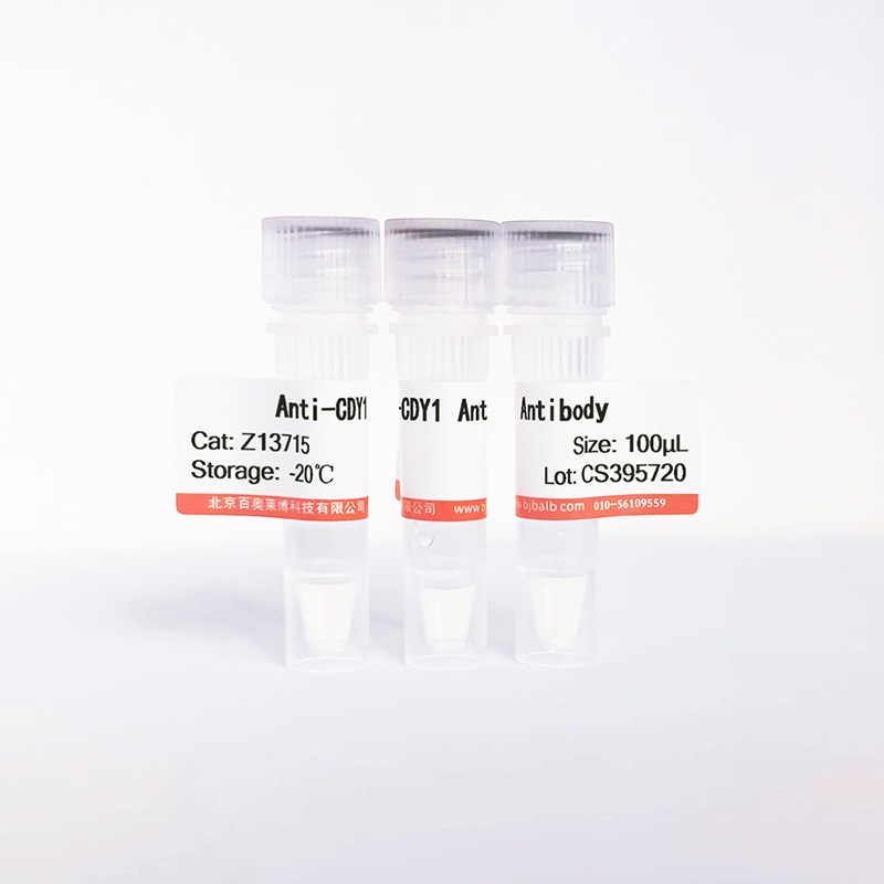 CDY1抗体图片 CDY1抗体图片