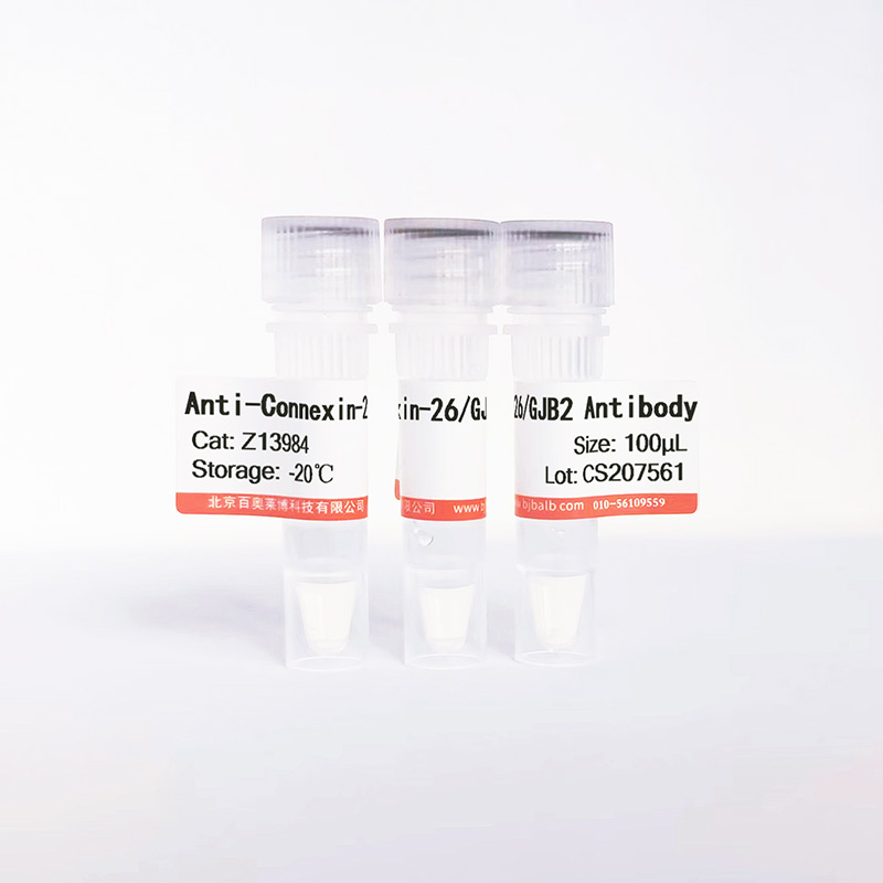Connexin-26/GJB2抗体图片 Connexin-26/GJB2抗体图片