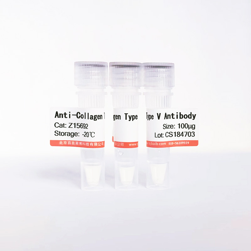 Collagen Type V抗体图片 Collagen Type V抗体图片