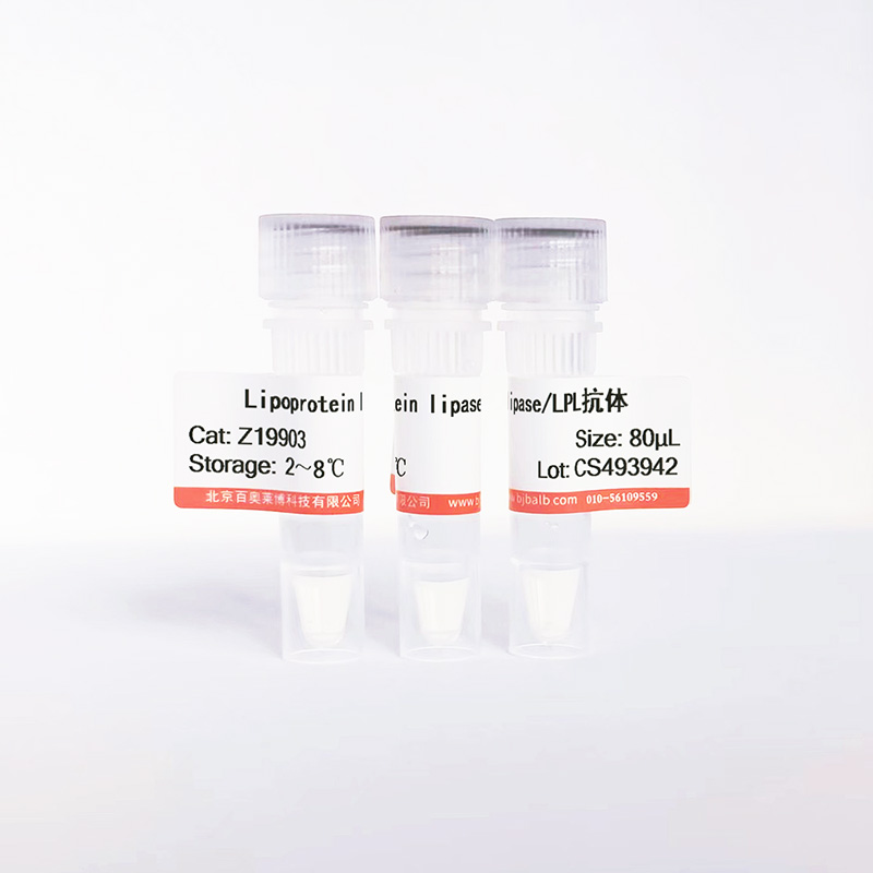 Lipoprotein lipase/LPL抗体图片