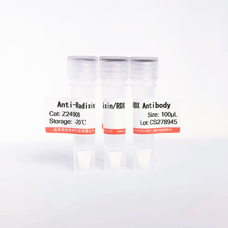 Radixin/RDX抗体图片