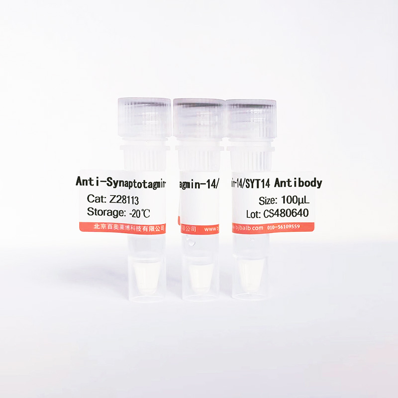 Synaptotagmin-14/SYT14抗体图片