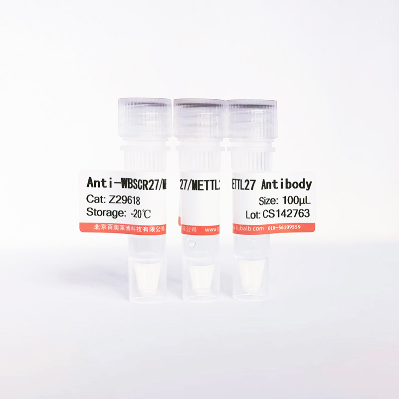 WBSCR27/METTL27抗体图片