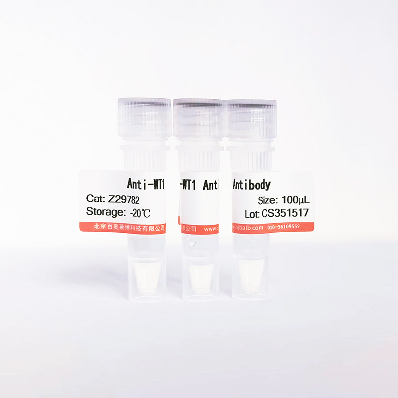 WT1抗体图片