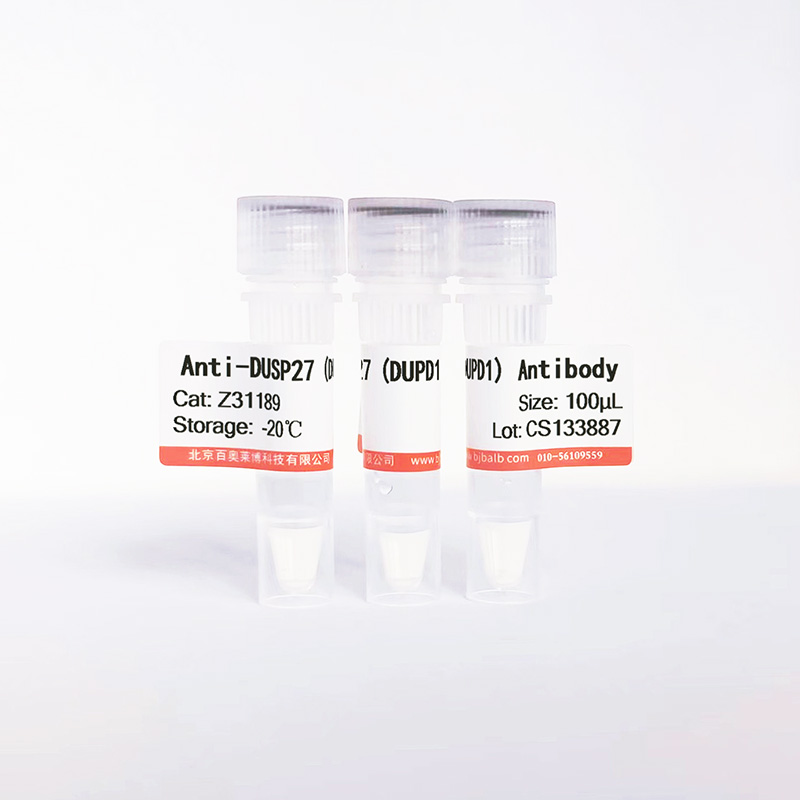 DUSP27 (DUPD1)抗体图片 DUSP27 (DUPD1)抗体图片