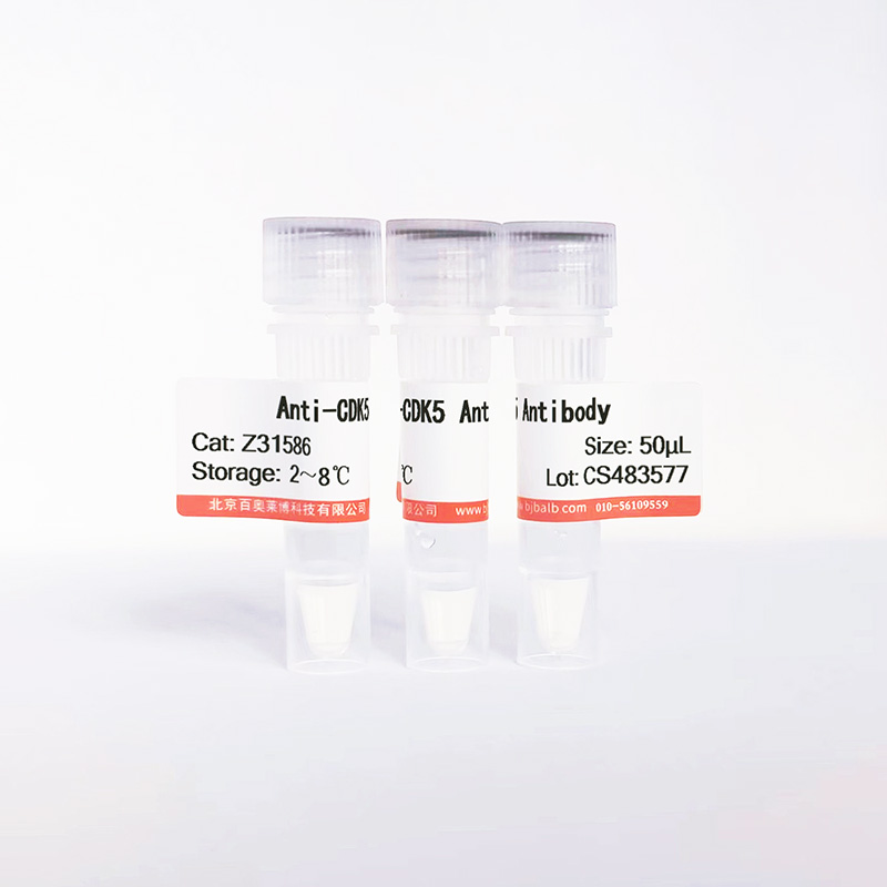 CDK5抗体图片 CDK5抗体图片