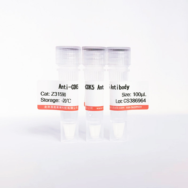 CDK5抗体图片 CDK5抗体图片