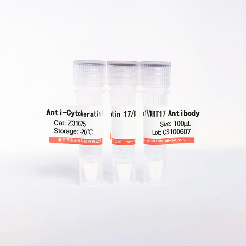 Cytokeratin 17/KRT17抗体图片