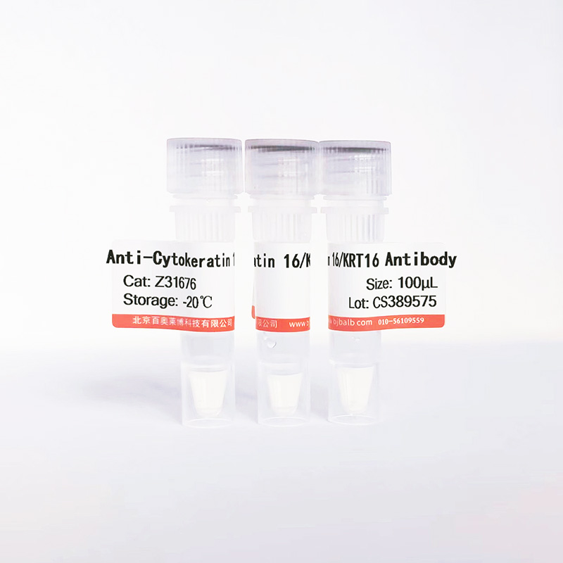 Cytokeratin 16/KRT16抗体图片