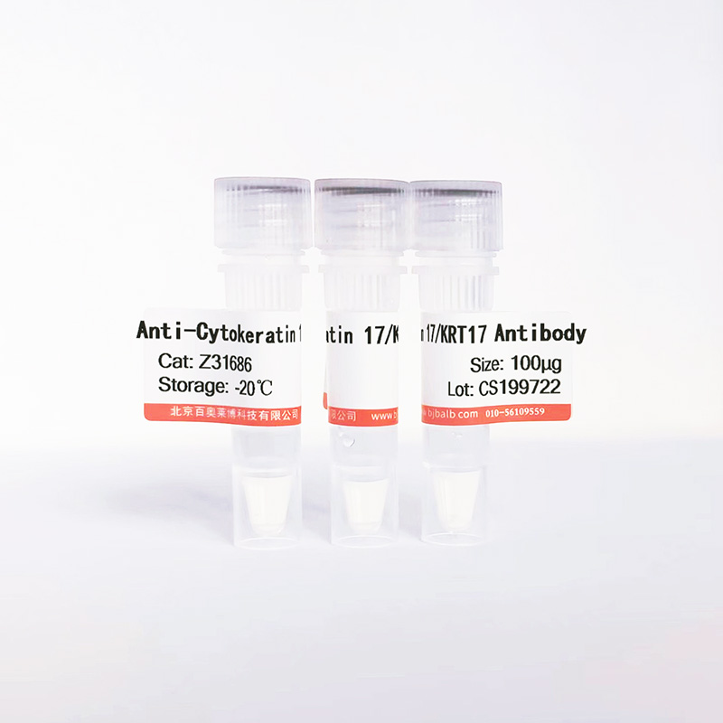 Cytokeratin 17/KRT17抗体图片 Cytokeratin 17/KRT17抗体图片