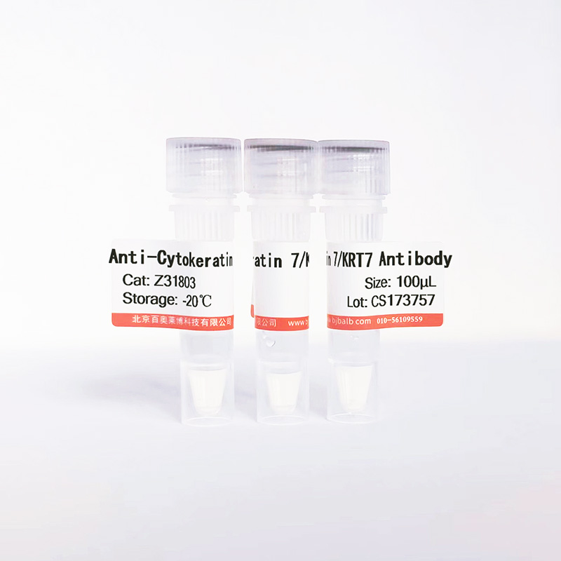 Cytokeratin 7/KRT7抗体图片 Cytokeratin 7/KRT7抗体图片