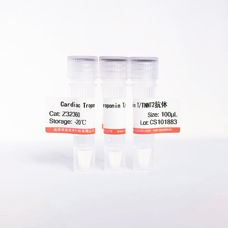 Cardiac Troponin T/TNNT2抗体图片