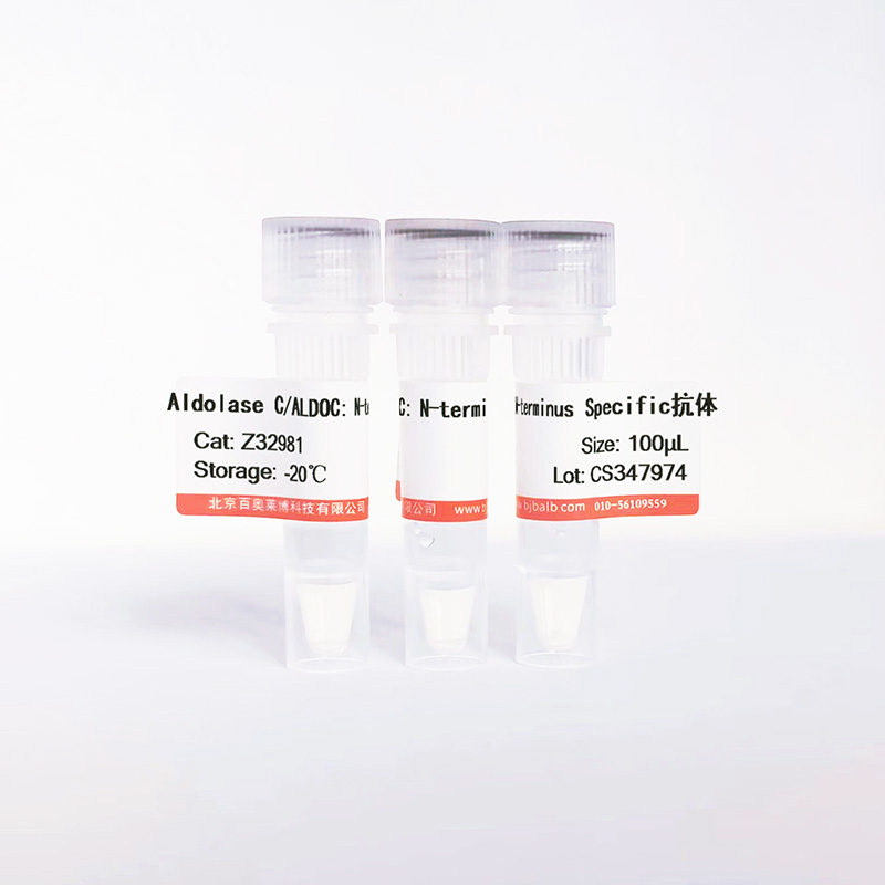 Aldolase C/ALDOC: N-terminus Specific抗体图片