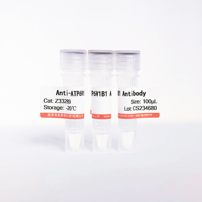 ATP6V1B1抗体图片