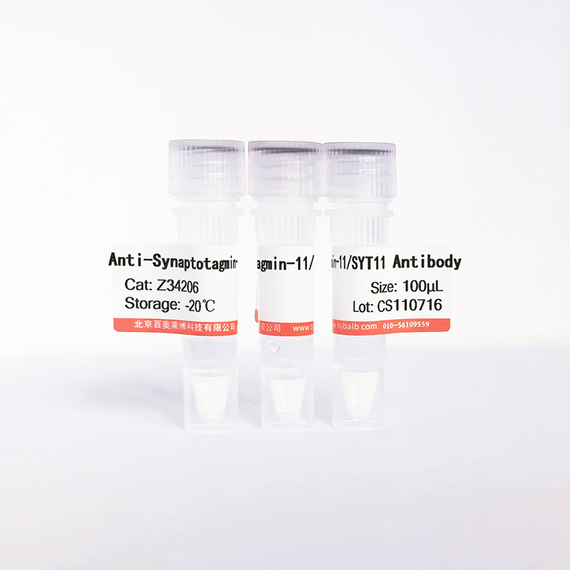 Synaptotagmin-11/SYT11抗体图片