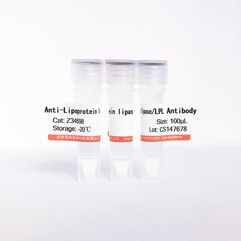 Lipoprotein lipase/LPL抗体图片